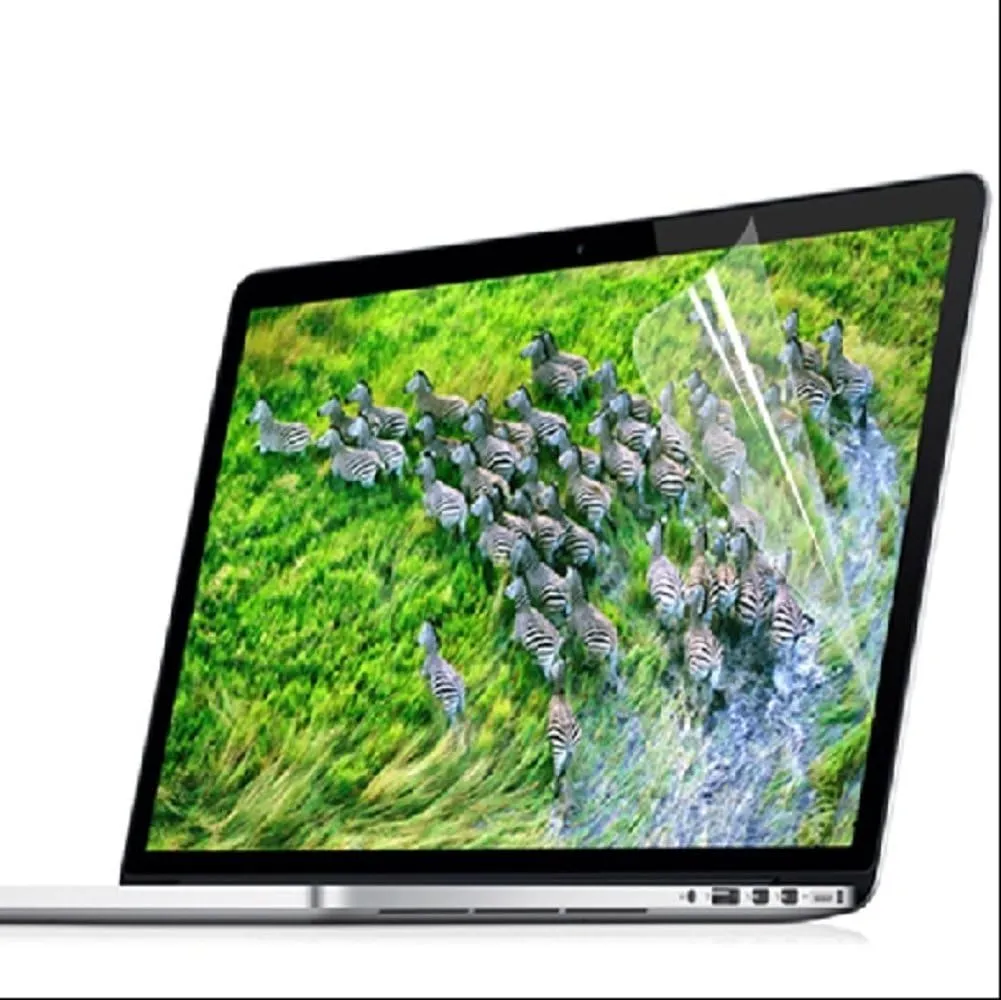 Se7enline Compatible with MacBook Pro 15 inch Case Model A1398 2015/2014/2013/2012 Laptop Hard Shell Protective Case&Sleeve Bag&Keyboard Cover Skin&Screen Protector&Dust Plug,Matte Transparent